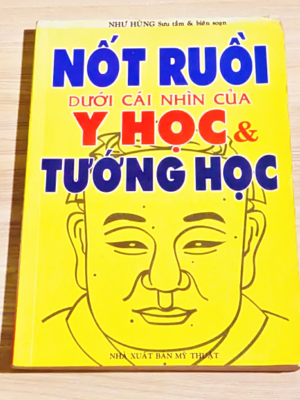 Nốt Ruồi Dưới Cái Nhìn Của Y Học Và Tướng Học